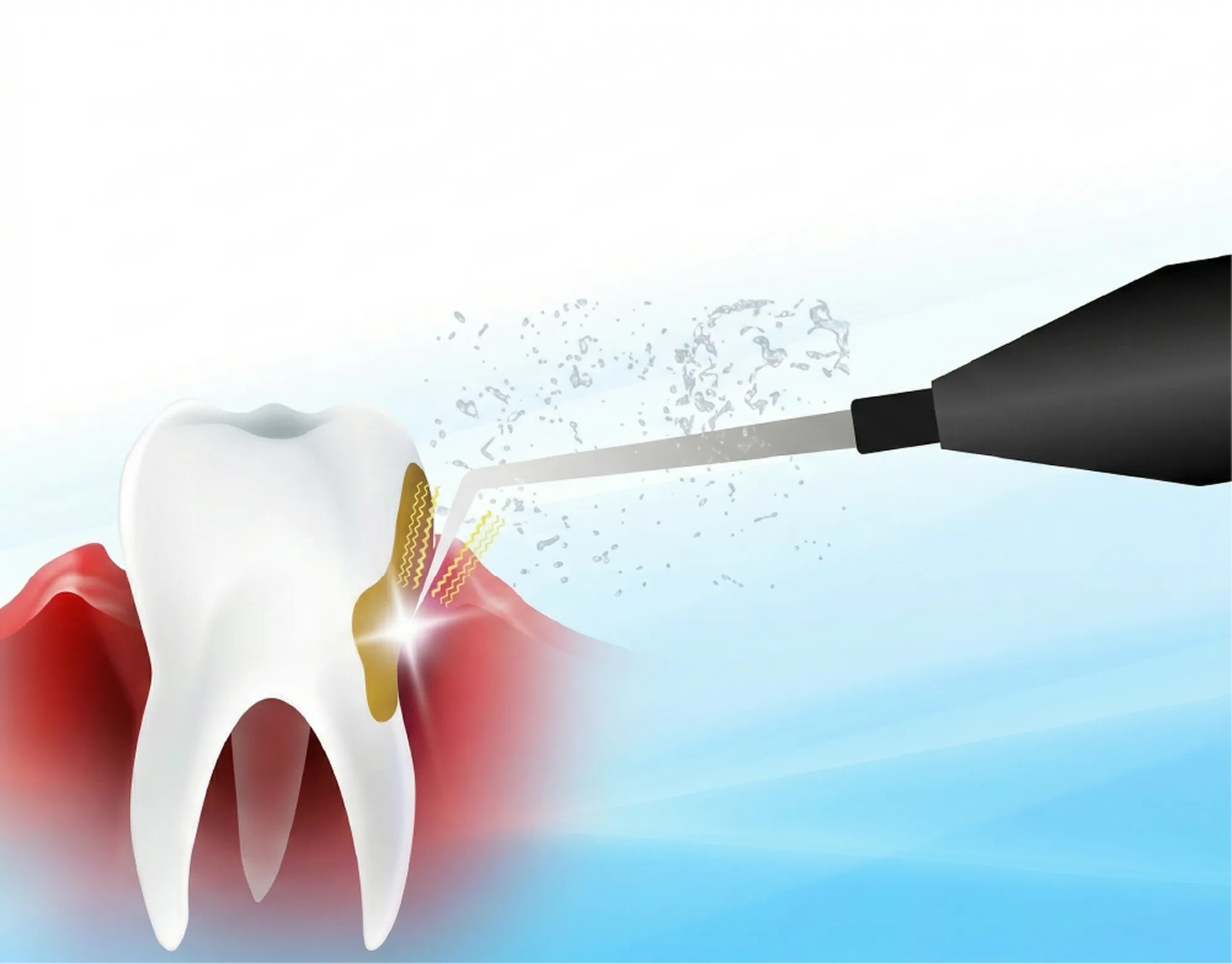 ブルーラジカルとは？