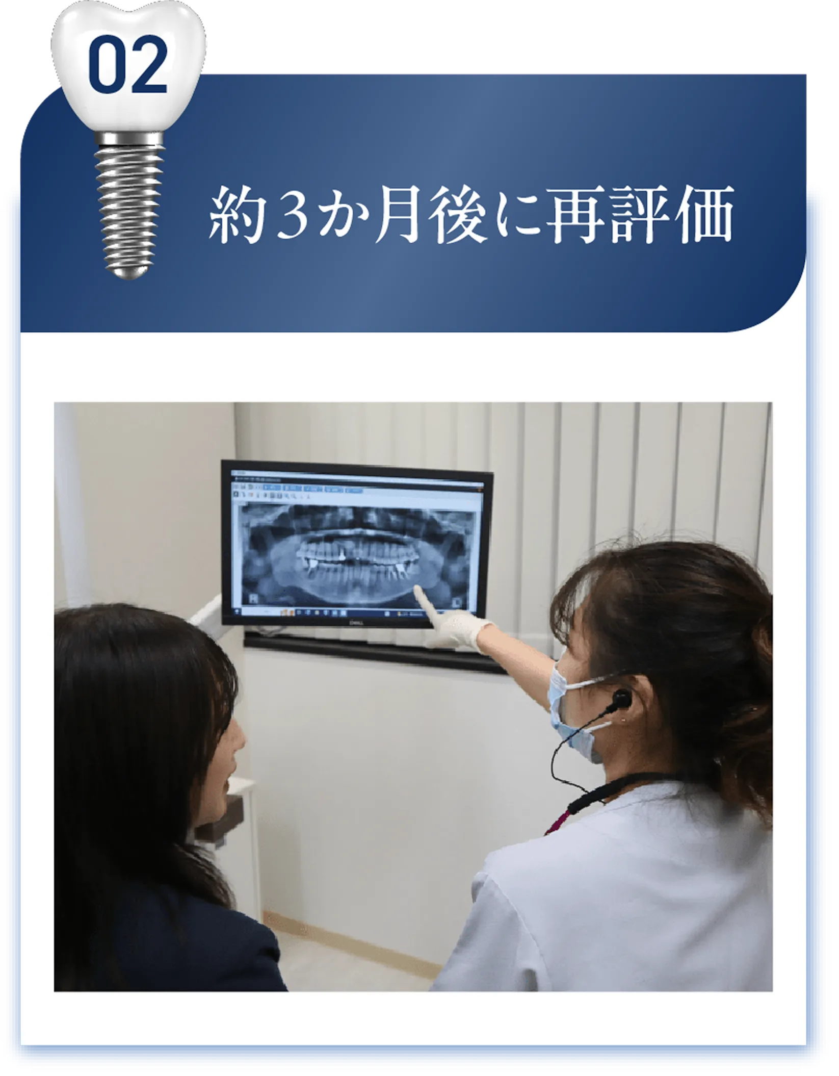 約3か月後に再評価