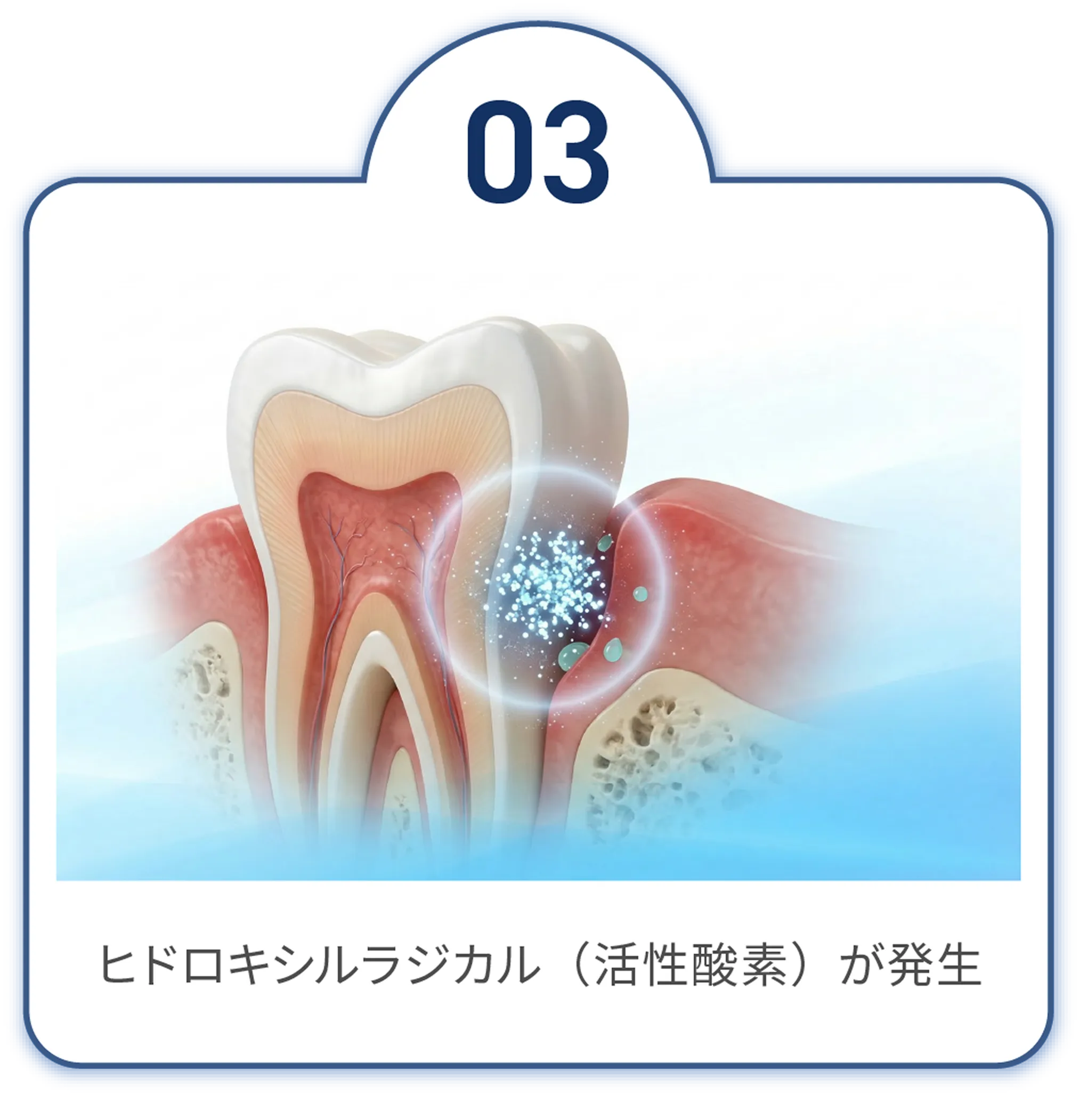 反応　ヒドロキシルラジカル（活性酸素）が発生。